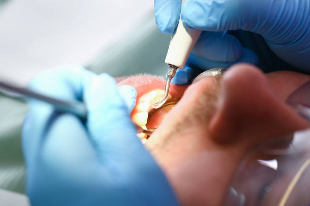 Best Emergency Dental Care for Trauma or Injury in Kingman, KS